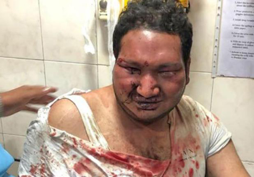 vidhwath 24 mar 18